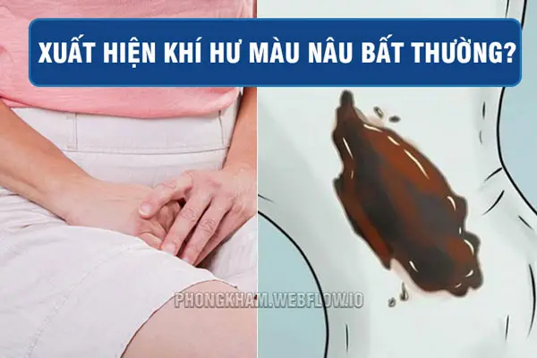 Nguyên nhân vùng kín ra dịch màu nâu đen không mùi