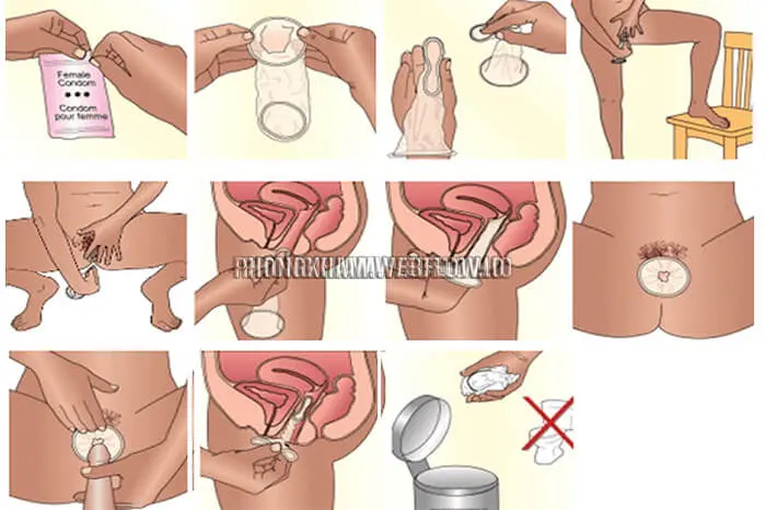 Hướng dẫn cách đeo bao cao su nữ