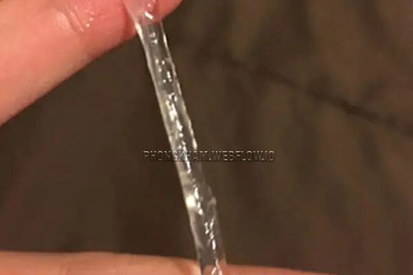 Bị ra nhiều khí hư màu trắng trong do viêm cổ tử cung