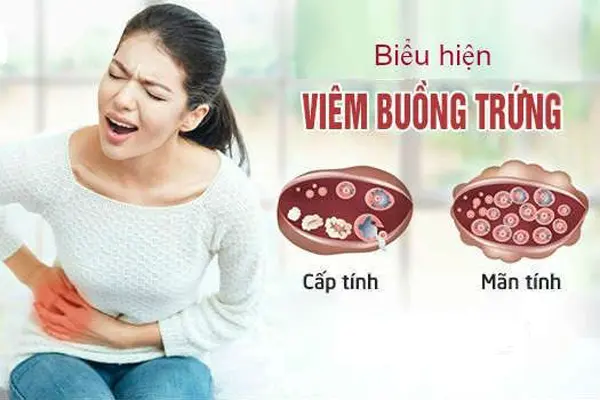 Thông tin về bệnh viêm buồng trứng ở nữ giới