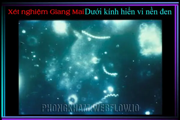 Phương pháp xét nghiệm giang mai bằng kính hiển vi nền đen