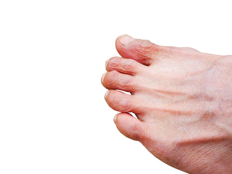 Foot and nail care Nursing care and interventions