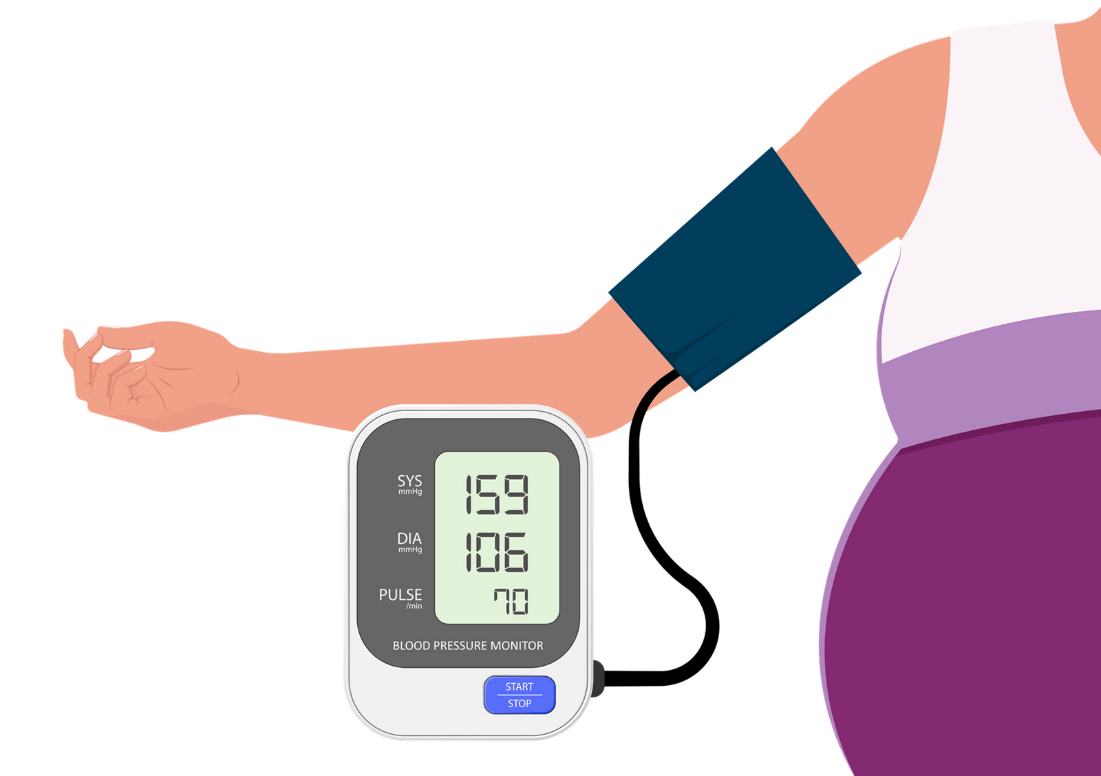 Hypertension In Pregnancy