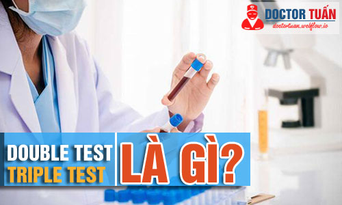 Double test và triple test là gì? Làm double hay triple test khi nào?
