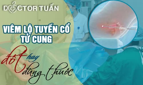 Tư vấn chữa viêm lộ tuyến cổ tử cung bằng đốt điện hay bằng thuốc