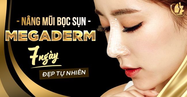 Nâng mũi bọc sụn megaderm là gì