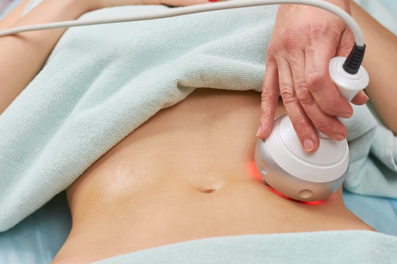 woman removing unwanted fat from her mid section (tummy) with radio frequency body sculpting
