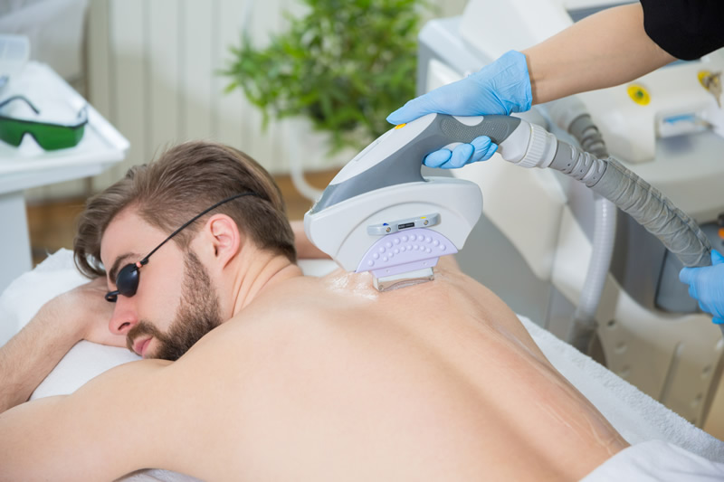 man getting back hair removed