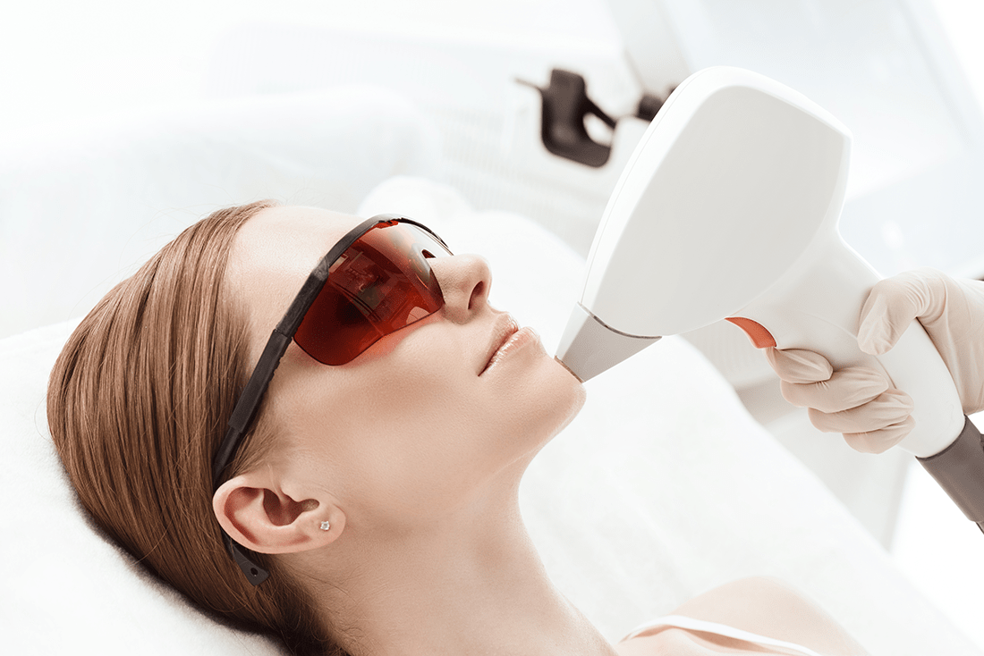 Laser Resurfacing with CO₂ Laser Skin Rejuvenation