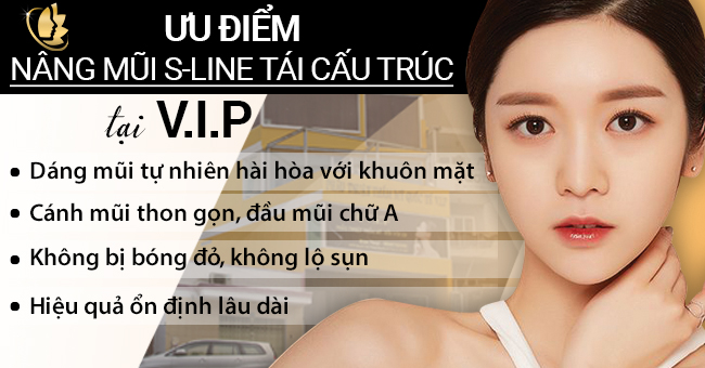 ưu điểm nâng mũi s line cấu trúc