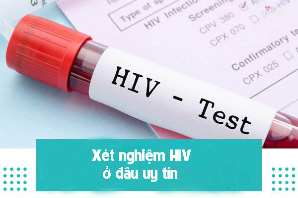 xét nghiệm hiv ở đâu