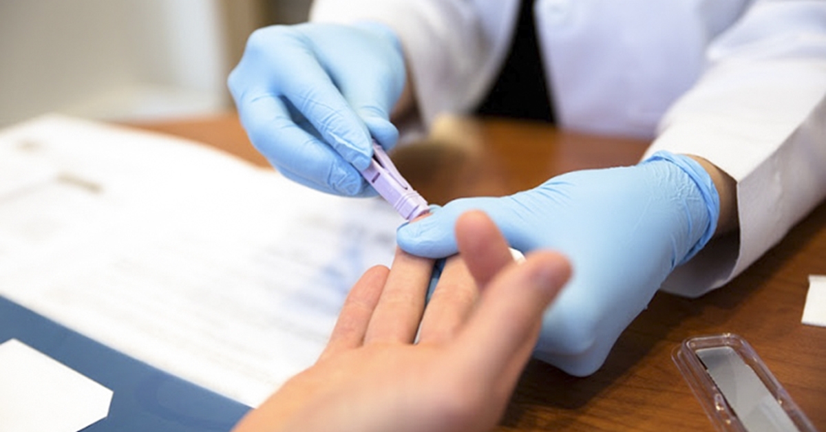 xét nghiệm test nhanh hiv