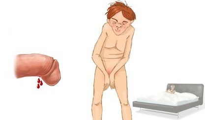 Rách dây thắng bao quy đầu phải làm sao chữa