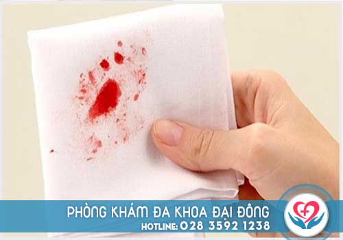 Đi cầu ra máu là bệnh gì
