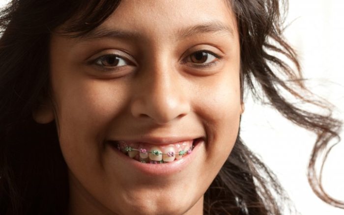 KEEPING KID’S TEETH HEALTHY