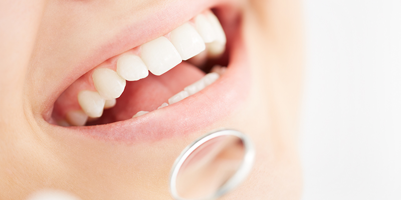 WHY YOU MUST LOOK INTO DENTAL IMPLANTS