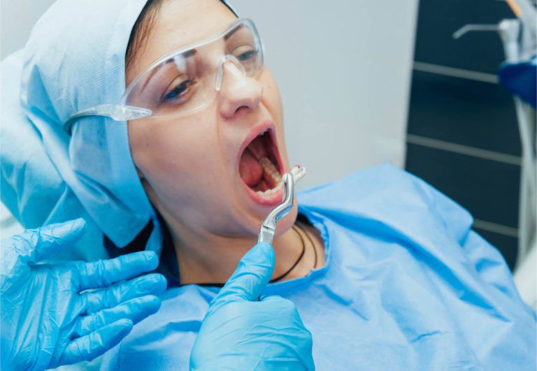 Wisdom Teeth Symptoms that Indicate Time Extraction