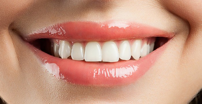 All- on-4 Dental Implant Treatments - Procedure, Recovery and Risks