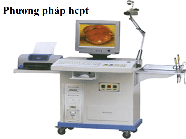 Kinh nghiệm từng đi cắt trĩ