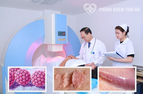 Địa chỉ bệnh viện, phòng khám chữa sùi mào gà ở Hà Nội