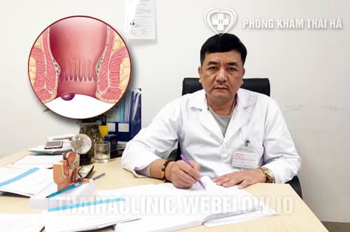 Bệnh trĩ có tái phát không