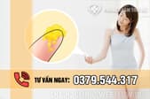 Huyết trắng màu vàng là bị bệnh gì và có sao không?
