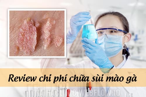 Chi phí chữa sùi mào gà hết khoảng bao nhiêu tiền