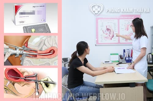 Tư vấn các cách phá thai an toàn hiện nay