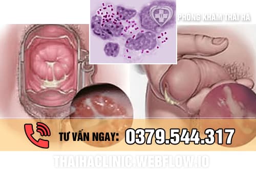 Hình ảnh bệnh lậu ở nam và nữ giới