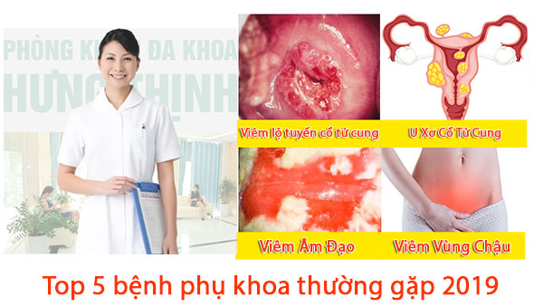 Top 5 bệnh phụ khoa thường gặp 2019