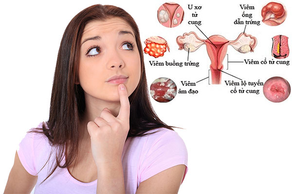 Bệnh phụ khoa là gì nguyên nhân triệu chứng cách chữa