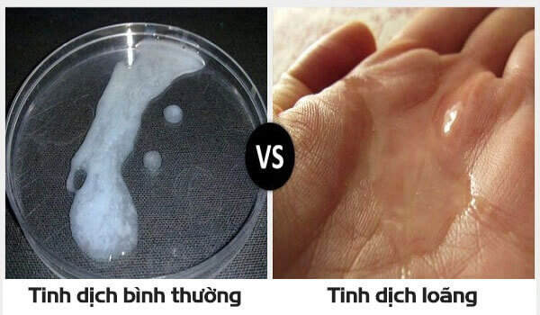 Tinh trùng loãng như nước có sao không?