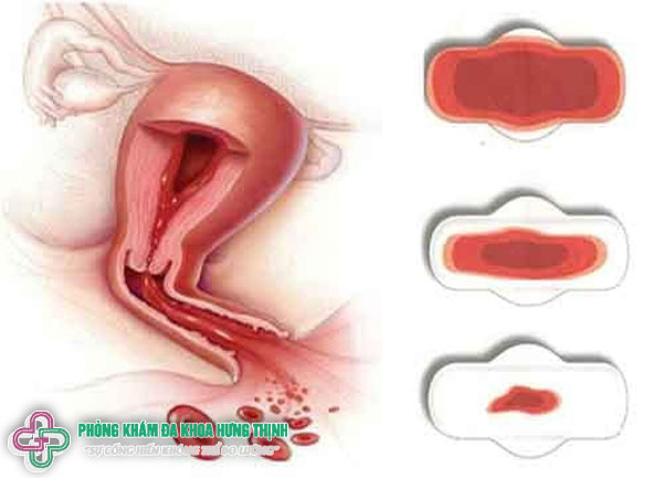 Rong kinh là gì có nguy hiểm không, nên ăn uống gì cách điều trị