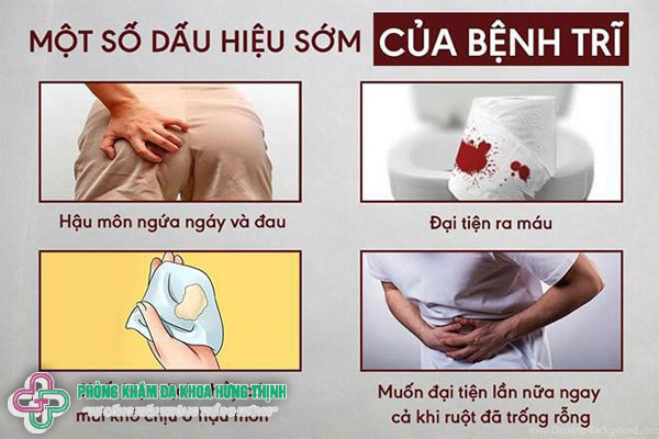 8 dấu hiệu bệnh trĩ thường gặp nhất