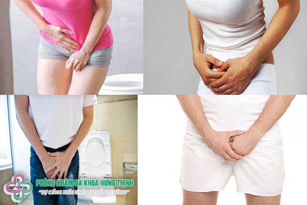 Bí tiểu lúc nào cũng có cảm giác buồn tiểu là bệnh gì