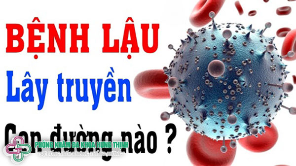 Bệnh lậu lây qua đường nào?