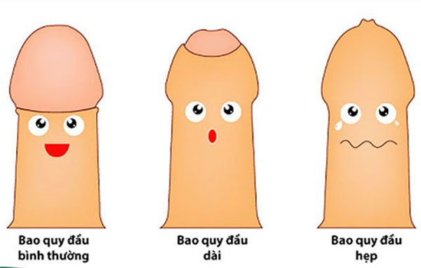 Thế nào là dài bao quy đầu?