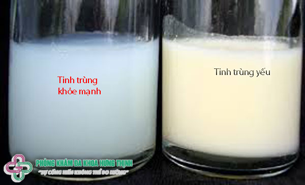 Làm sao biết tinh trùng yếu?