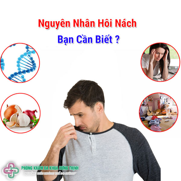 Nguyên nhân bệnh hôi nách