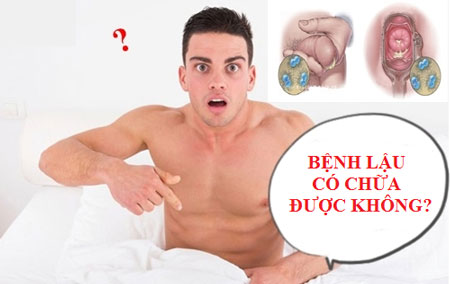 Bệnh lậu có chữa khỏi được không?