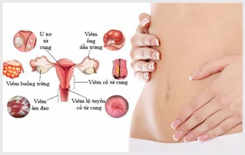 Bệnh phụ khoa là gì?