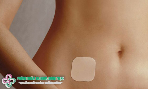 Miếng dán tránh thai là gì? Nguyên lý hoạt động của miếng dán tránh thai