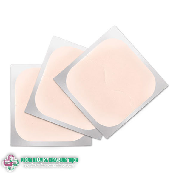 Cách sử dụng miếng dán tránh thai