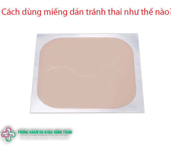 Cách dùng miếng dán tránh thai như thế nào?