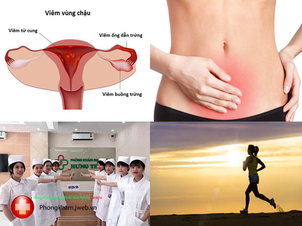 Cách điều trị bệnh viêm vùng chậu