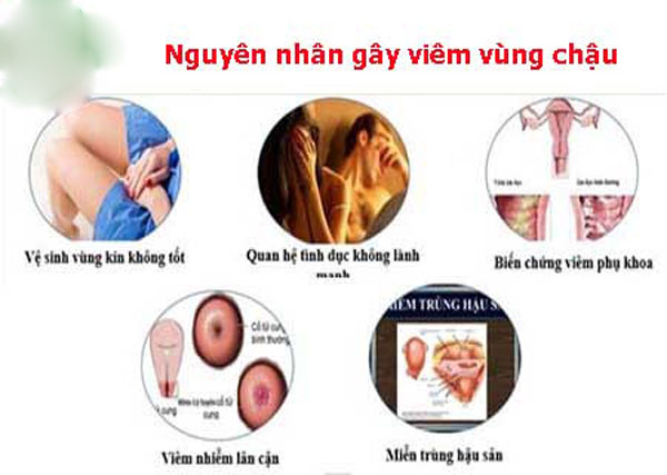 Nguyên nhân dẫn đến viêm vùng chậu