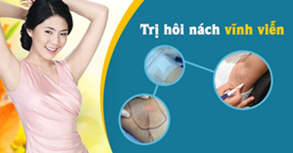 Cách chữa hôi nách hiệu quả triệt để nhất hiện nay