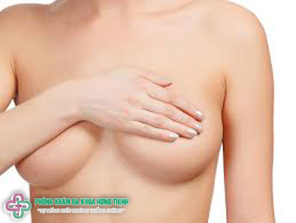 Tại sao sau khi sinh vòng 1 nữ giới lại chảy xệ?