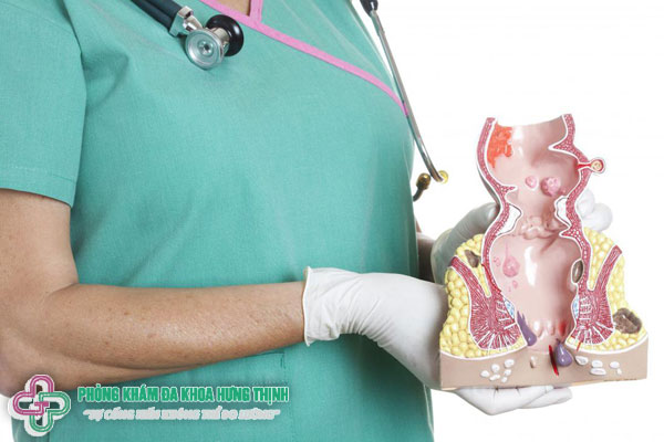 Cách chữa đi ngoài ra máu thế nào?