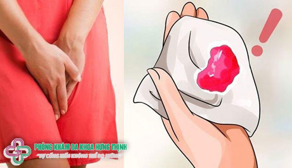 Kinh nguyệt là gì?